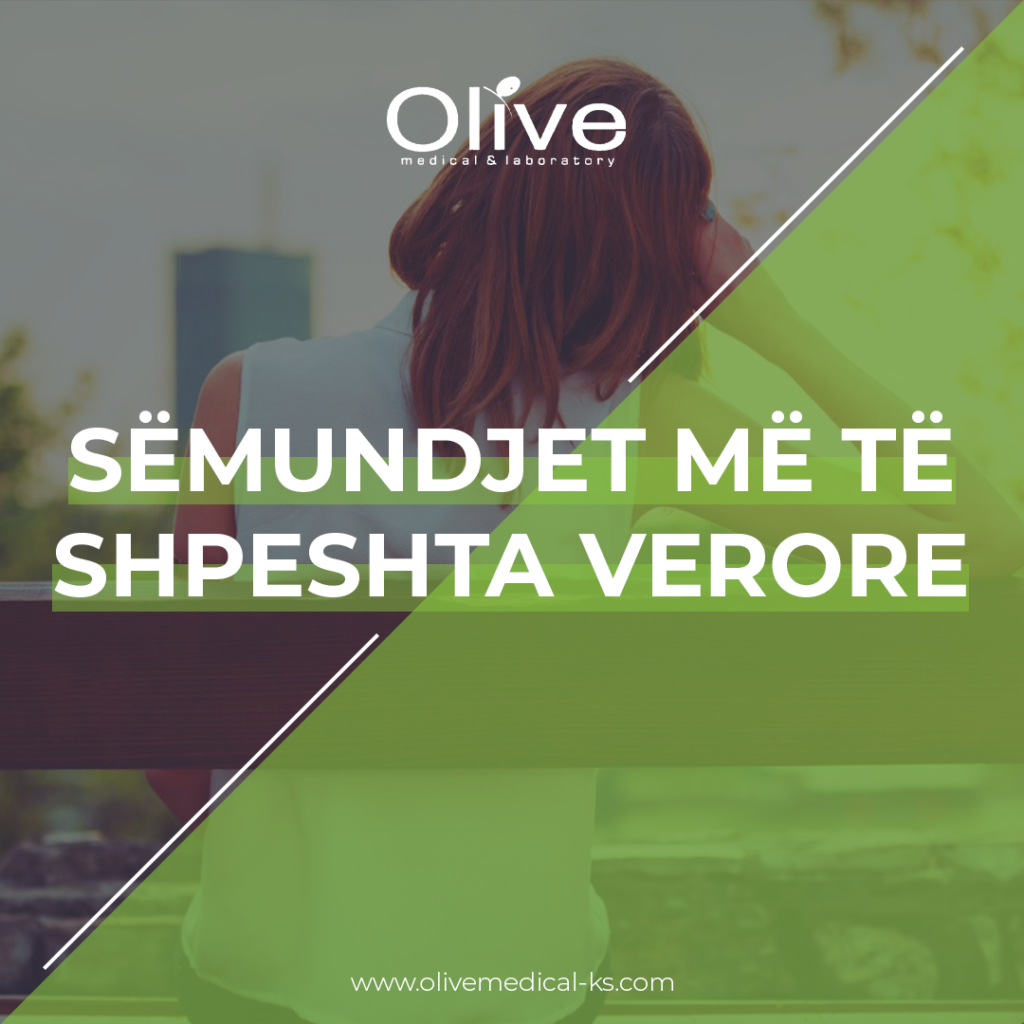 Sëmundjet më të shpeshta verore